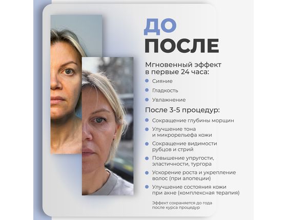 AGT Bio Nucleo 20 - Биорепарирующий комплекс (БЕЗ УПАКОВКИ)