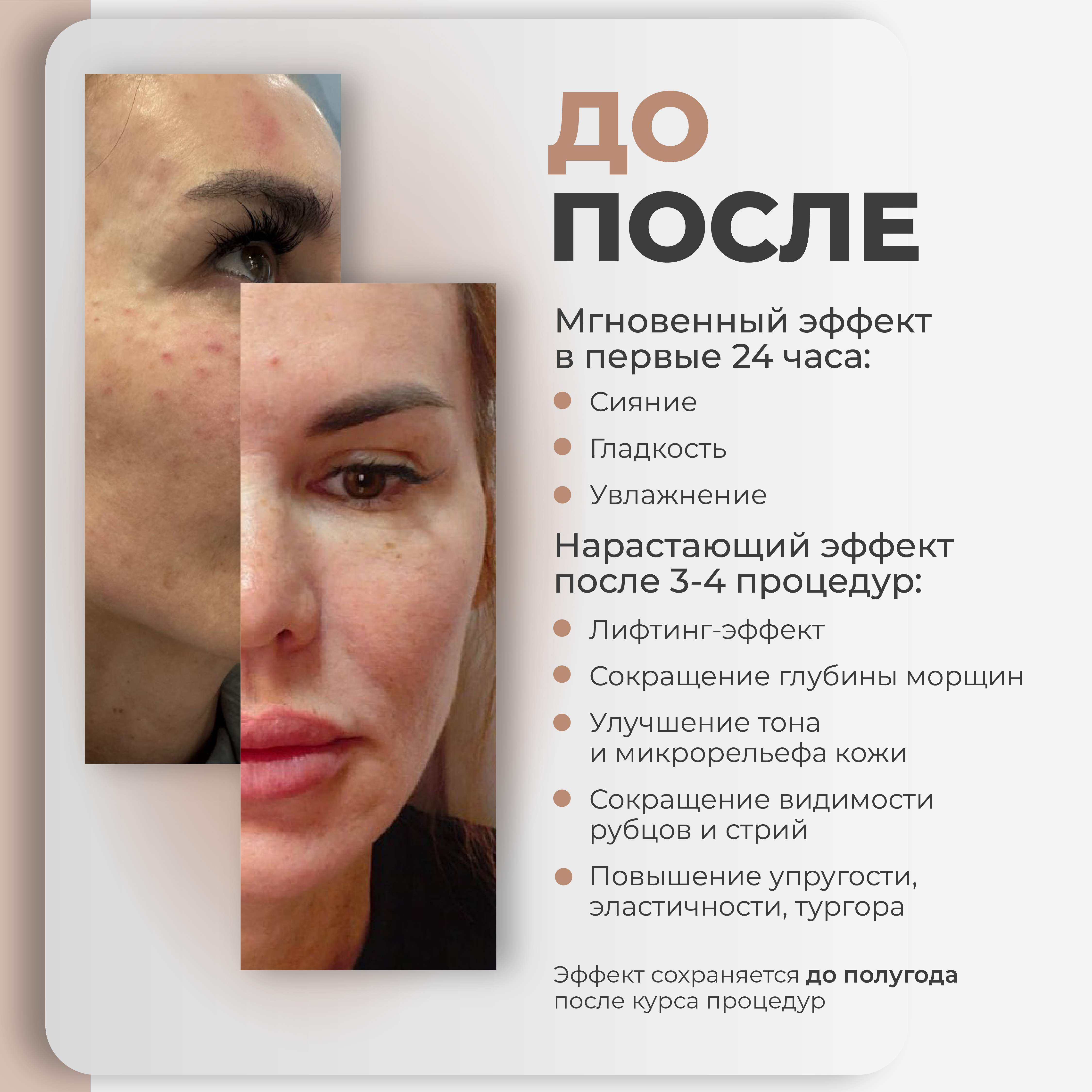 AGT Bio Cologenum Plus - Биорепарант с RHLC и PDRN AGT Bio Cologenum Plus - Биорепарант с RHLC и PDRN