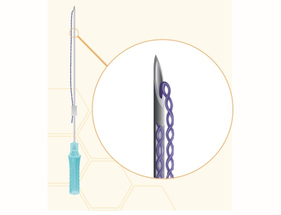 Honey Derma Thread TWIST PDO