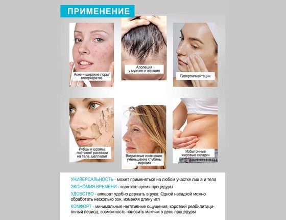 Дермапен ULTIMA - А1 - W Аппарат для фракционной мезотерапии